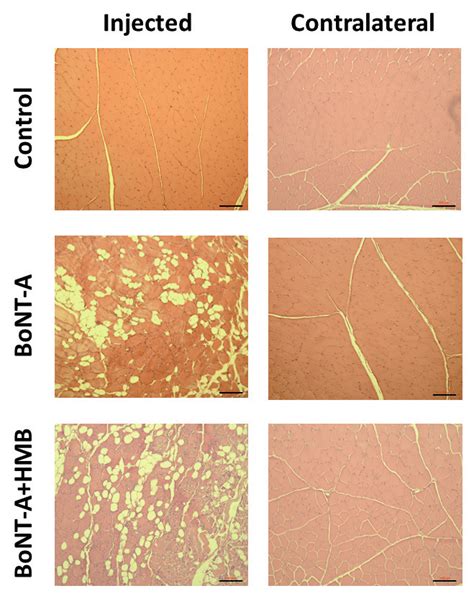 Exemplar Histological Cross Sectional Images Showing The Percentage Of