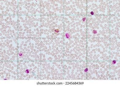 Smear Blood Under Microscope Leukocytes Located Stock Illustration ...