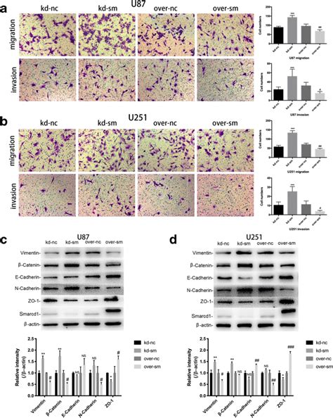 Smarcd1 Suppressed The Migration And Invasion Ability Of Glioblastoma