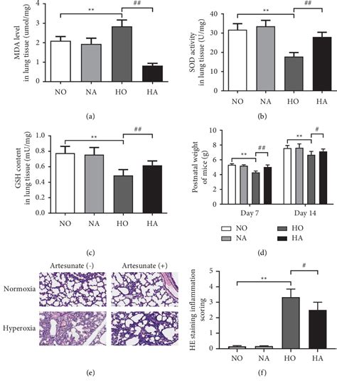 Figure From Artesunate Alleviates Hyperoxia Induced Lung Injury In