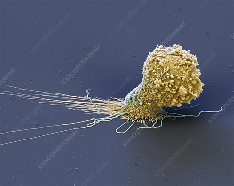 Macrophage Engulfing Bacteria Sem Stock Image C Science