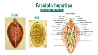 Liver Flukes F Hepatica F Gigantica Ppt