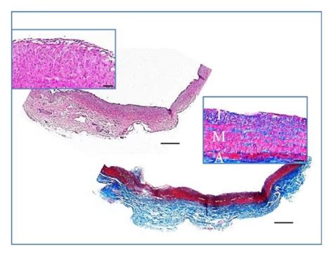 Morphometric Results Panel A And Histologic Characterization