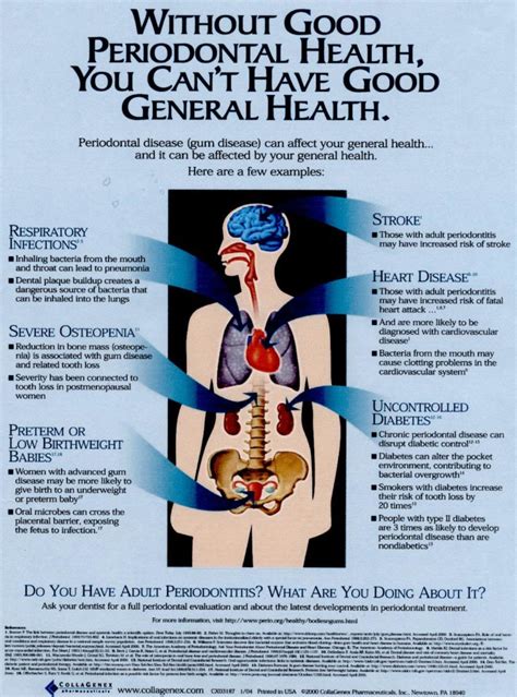 Oral Systemic Health Overview For Dentists Gums Of Steel