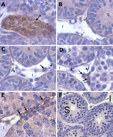 A C Light Micrograph Of Postnatal Day 10 Testis Showing A Fetal Leydig