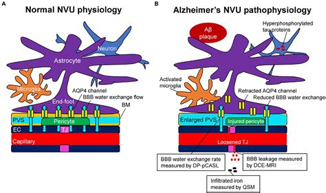 Frontiers Contributions Of Bloodbrain Barrier Imaging To