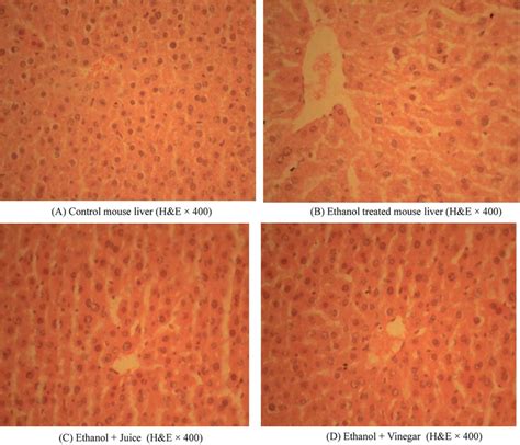 Representative Photomicrographs Of Livers In Control And Experiment Download Scientific Diagram