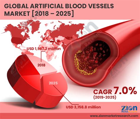 Global Artificial Blood Vessels Market Set For Rapid Growth To Reach