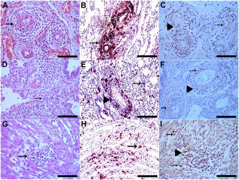 Frontiers Porcine Circovirus Type 3 Immunohistochemical Detection In