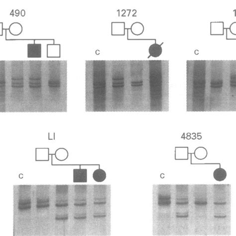 Pdf Pcr Based Mutation Screening Of The Laminin α2 Chain Gene Lama2