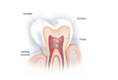 O Que Sensibilidade No Dente Ortocoi Cl Nica Ortod Ntica