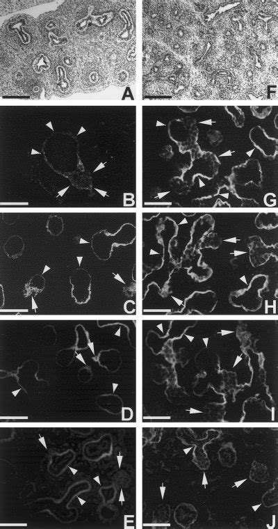 Distribution Of Laminin 5 Ln5 And Its α3 β3 And γ2 Chains During