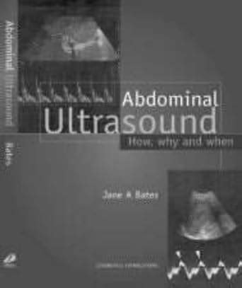 Abdominal Ultrasound How Why And When 9780443060076 Medicine