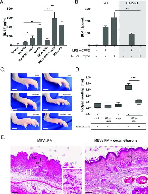 Mycobacterial Extracellular Vesicles Containing Mycolactone Induce