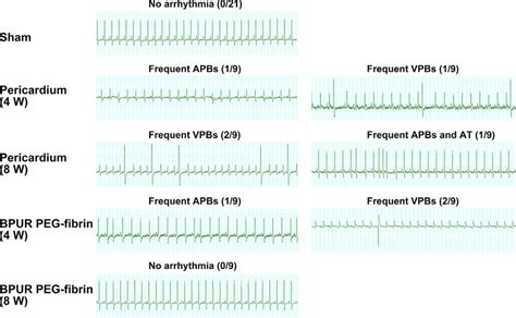 ECG arrhythmia recorded for 30 min at 4-and 8-weeks post surgery. There... | Download Scientific ...