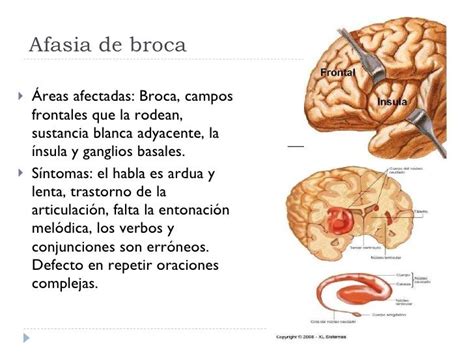 Pin On Neurociencias