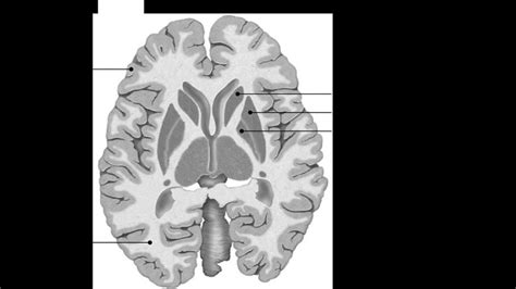 Transverse Section Of Cerebrum Showing Major Regions Of Cerebral Download Scientific Diagram