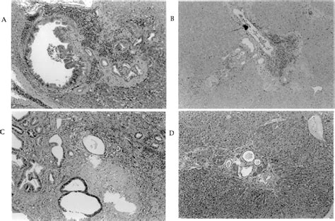 Figure 1 From Chemoprevention Of Biliary Carcinogenesis In Syrian