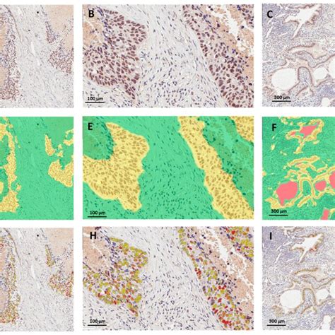 Image Analysis Workflow For Ihc Staining Quantification A D G Are