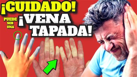 ¡atencion Estos Sintomas Indican Que Tenes Vasos Sanguienos Tapados Venas Tapadas Youtube