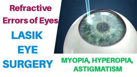 Refractive Errors Of Eyes Myopia Hyperopia Lasik Surgery Vivek Gaur Physiotherapist