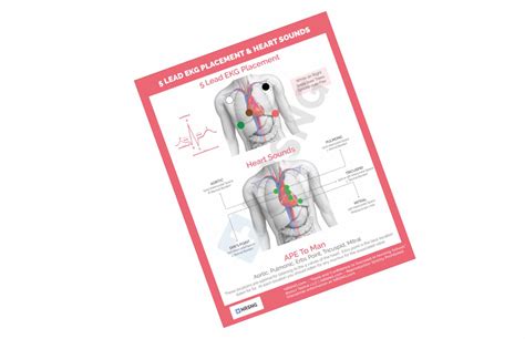 5 Lead Ekg Placement