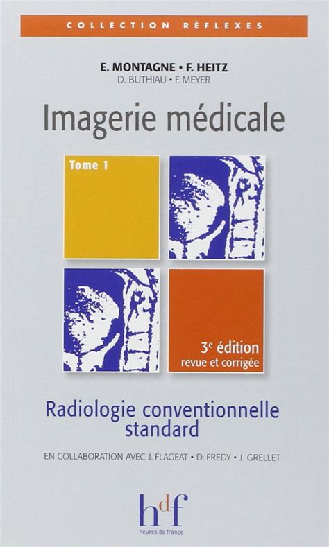 Amazon Fr Imagerie M Dicale Radiologie Conventionnelle Standard