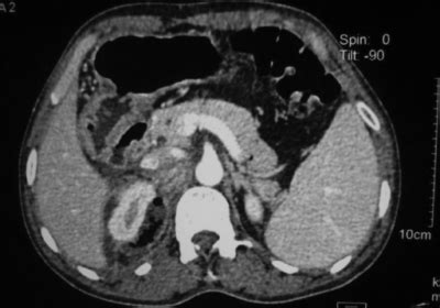 Imagenolog A Del Sistema Urinario Concise Medical Knowledge