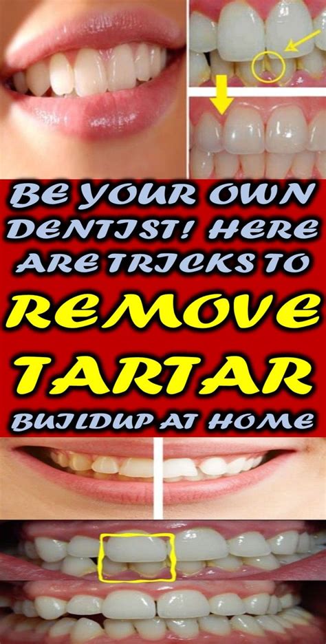 The Best How To Remove Stains From Teeth Uk 2022