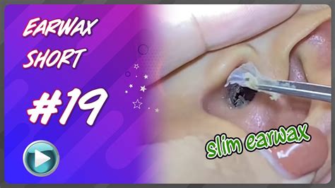 Remove Earwax Asmr Ear Cleaning Esp 19 Youtube