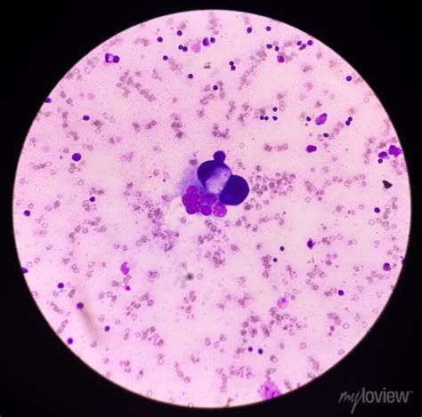 Microscopic View Of Blood Smear Hematological Stained Slide Posters