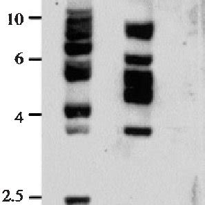 Southern Hybridization Analysis Of C Albicans And C Dubliniensis Dna