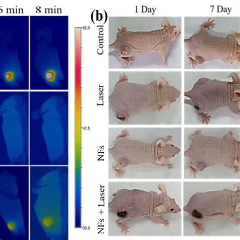 Thermal Ir Images Of The T Bearing Nude Mice After Intratumoral