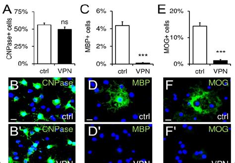 Expression Of Myelin Proteins CNPase MBP And MOG In Oligodendroglial