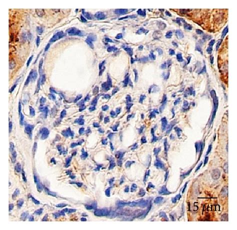 Aqp1 And Hsp60 Expression In The Glomeruli Immunohistochemical