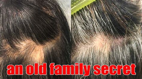 Turn White Hair Into Black White Hair To Black Permanently Turn