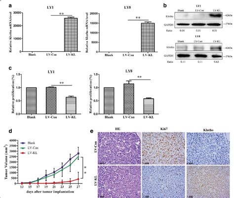 Klotho Suppressed Dlbcl Growth A B Relative Expression Levels Of Download Scientific Diagram