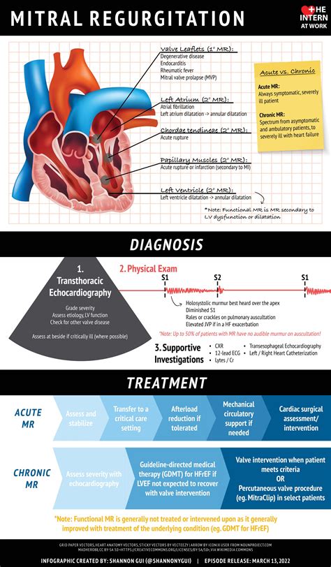 Mitral Valve Regurgitation What Is It Causes Diagnosis 58 Off