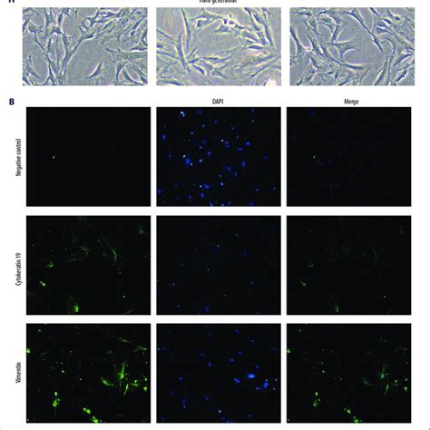 Western Blotting Analysis Showing The Expression Of Collagen Type I In Download Scientific