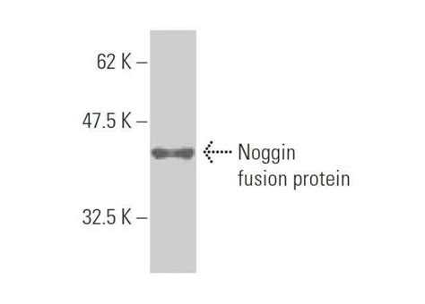 Noggin Antibody 2c10 Scbt Santa Cruz Biotechnology