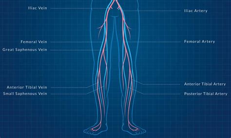 Get A Leg Up On Lower Extremity Revascularization Coding Aapc