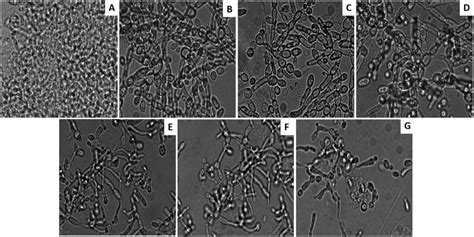 Microscopic Images Revealing Photodynamic Inhibition Of C Albicans