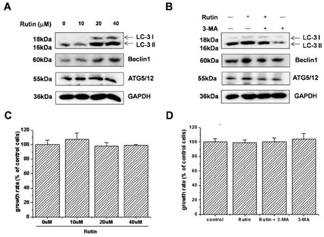 Rutin Induces Autophagy In Thp 1 Derived Macrophages A Thp 1 Derived Download Scientific