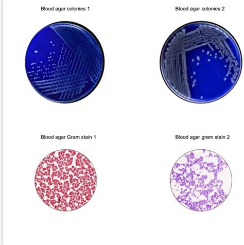 Solved Gram Positive Possibilities Describing And Interpreting The