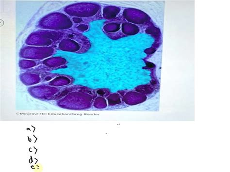 SOLVED: Which structure is highlighted? Medulla of lymph node. Capsule of lymph node. Trabecula ...