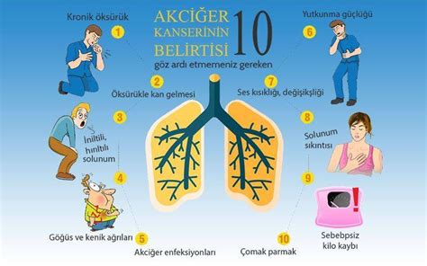 Akciğer Kanseri Belirtileri Evreleri Tanı ve Tedavisi Prof Dr