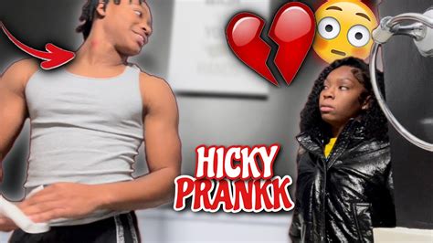 Hickey Prank On Girlfriend She Broke Up With Me Youtube