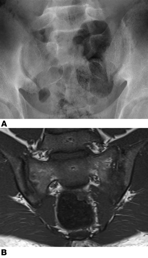 Diagnostic Utility Of Magnetic Resonance Imaging And Radiography In