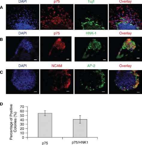 Induction Of Putative Neural Crest Stem Cells Ncscs From Human