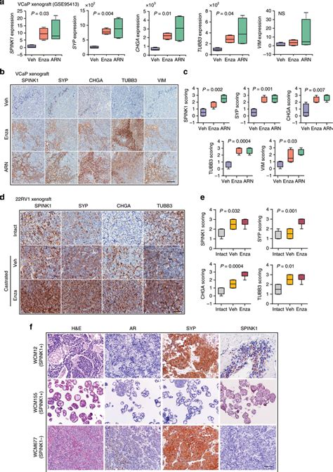 Adt Induced Spink Upregulation Associates With Ne Phenotype In Mice